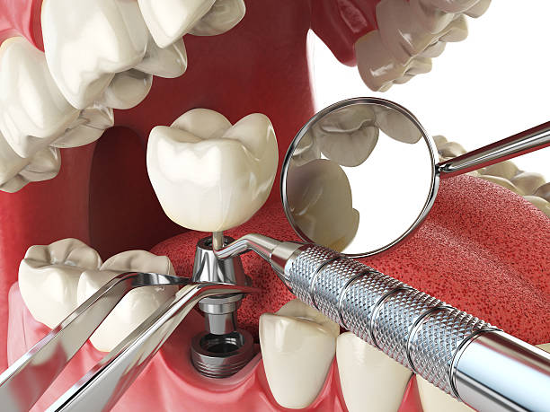 Emergency Dentist Open Today in WV